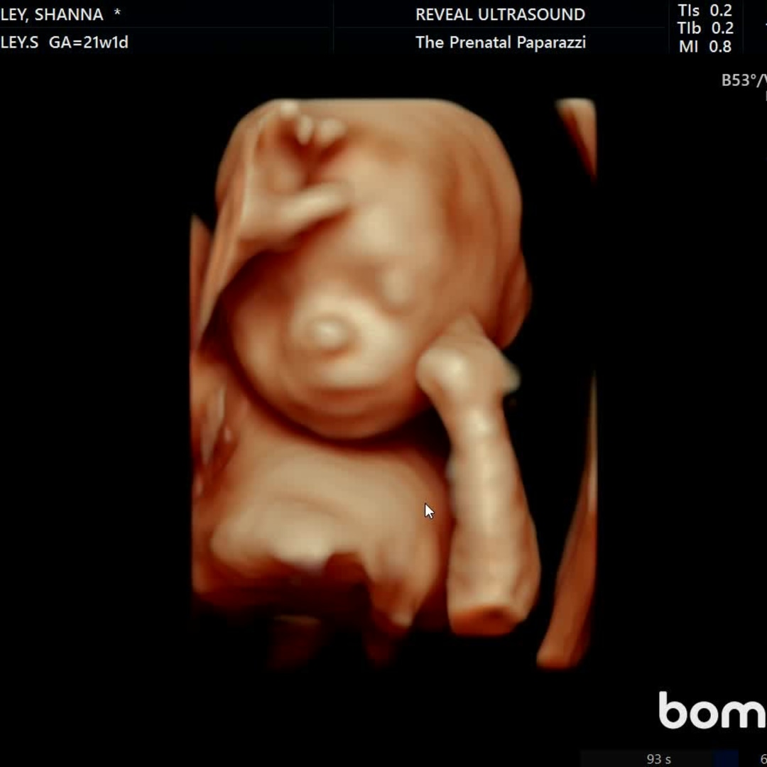 Photo shared by Shanna for their Babylist baby registry.