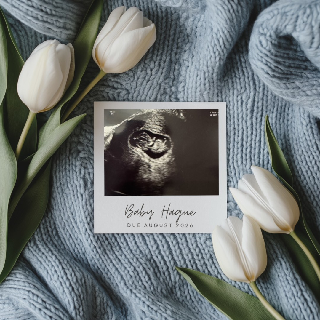 Photo shared by Ashley for their Babylist baby registry.