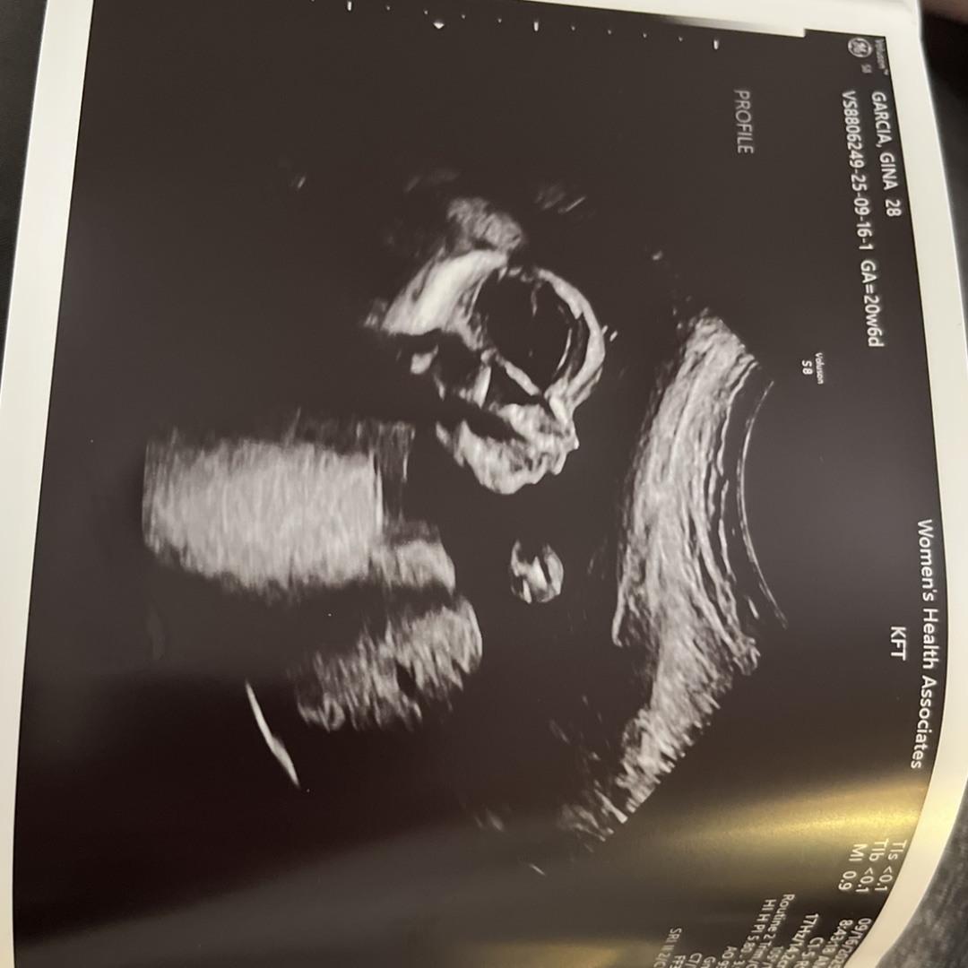Photo shared by Gina for their Babylist baby registry.