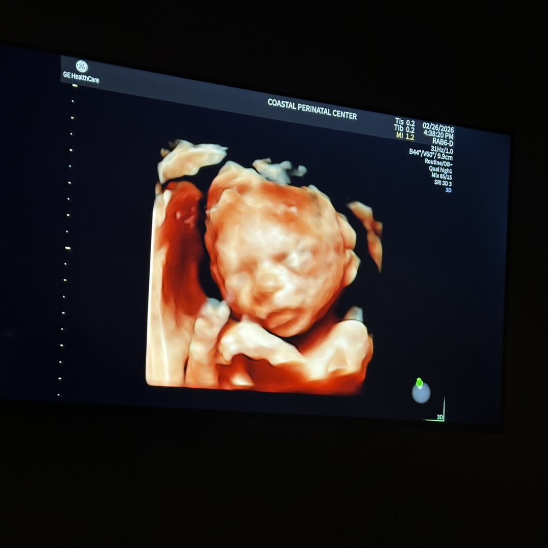 Photo shared by Kayden for their Babylist baby registry.