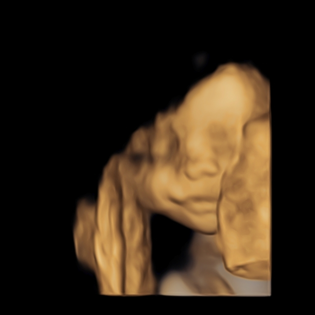 Photo shared by Courtney for their Babylist baby registry.