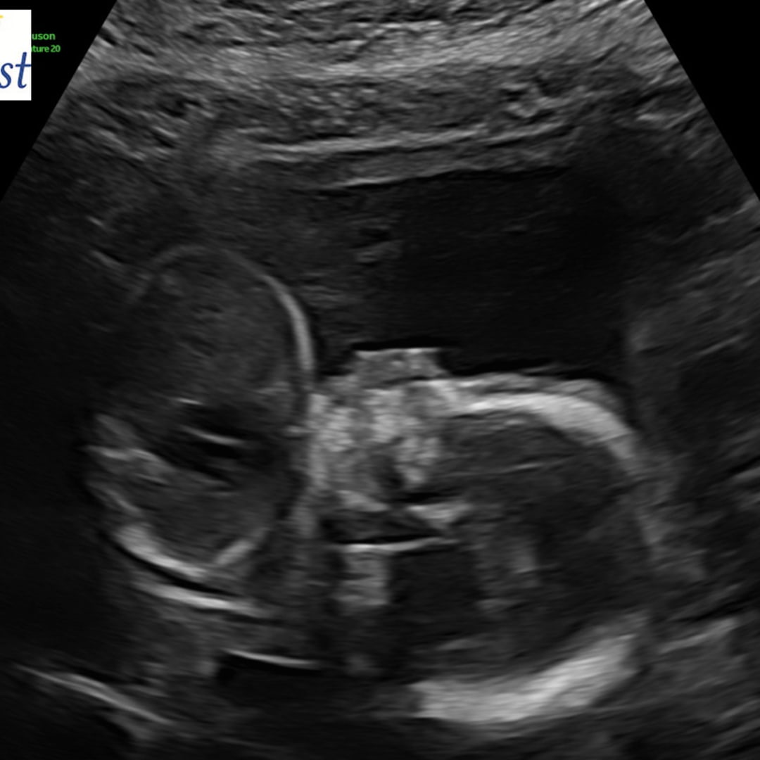 Photo shared by Bailey for their Babylist baby registry.