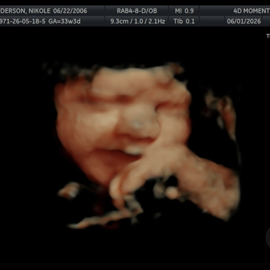 Photo shared by Nikole for their Babylist baby registry.
