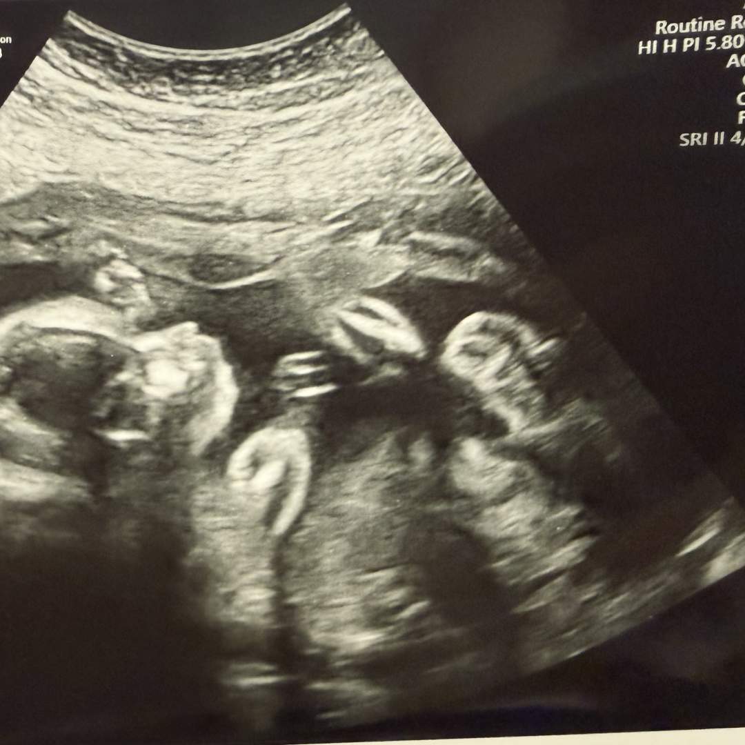 Photo shared by Ashlyn for their Babylist baby registry.