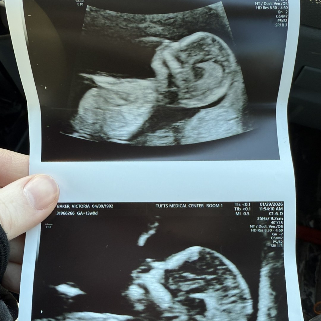 Photo shared by Victoria for their Babylist baby registry.