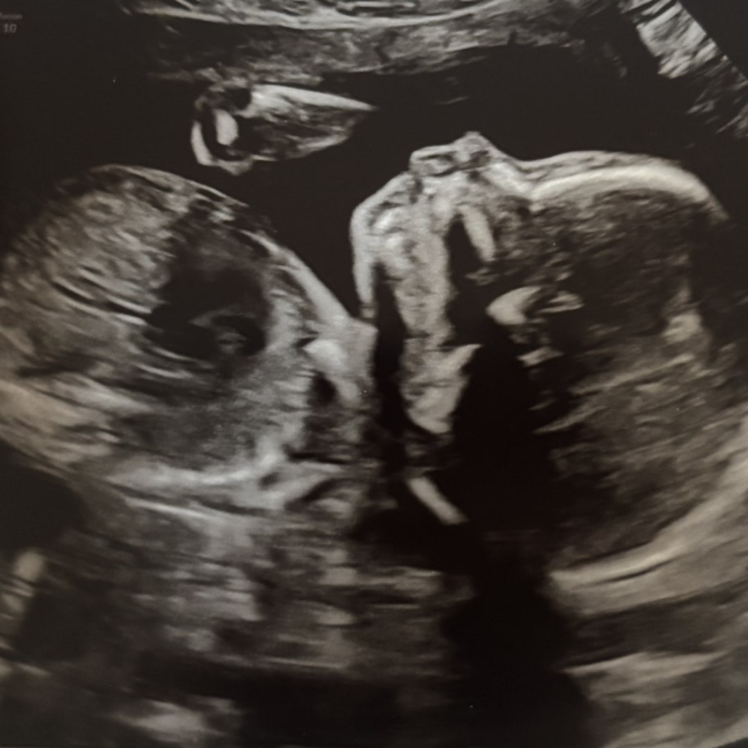 Photo shared by Kyla for their Babylist baby registry.