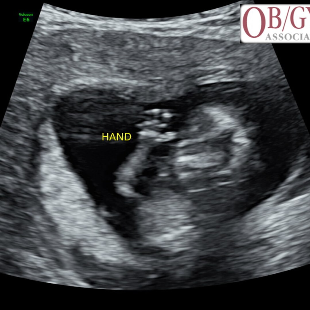 Photo shared by Jade for their Babylist baby registry.