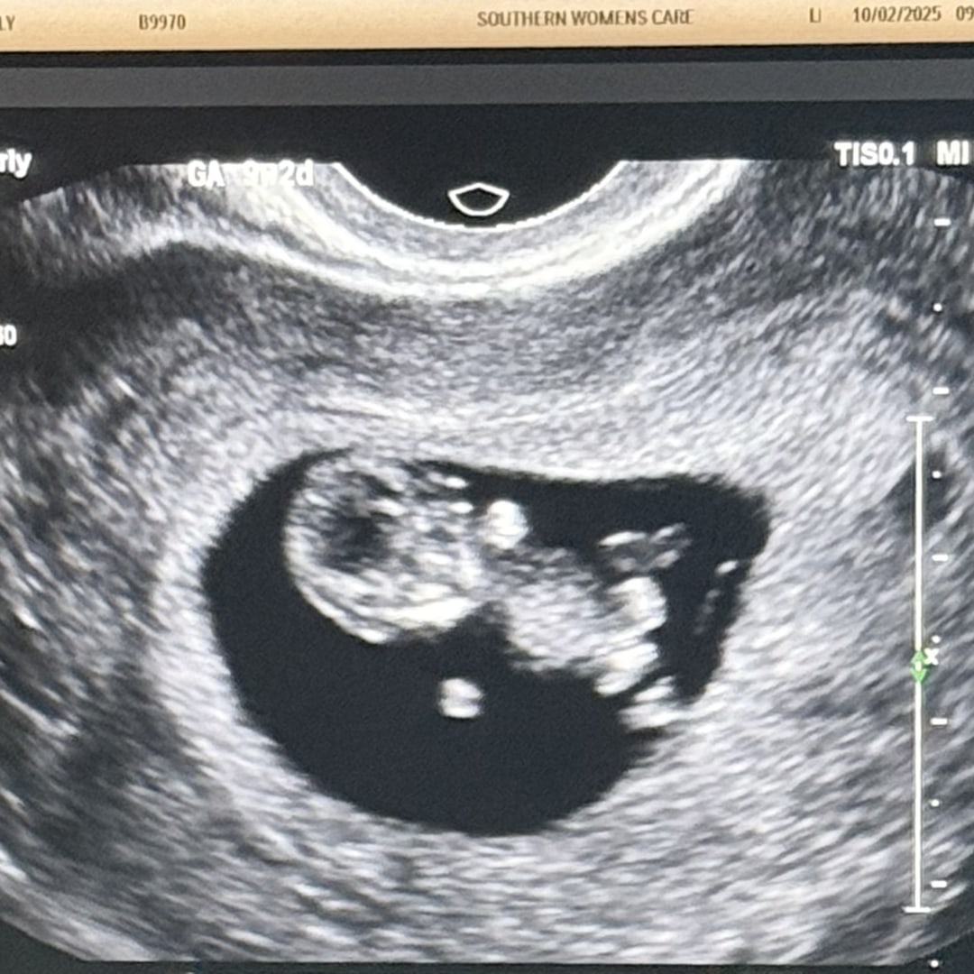 Photo shared by Carley for their Babylist baby registry.