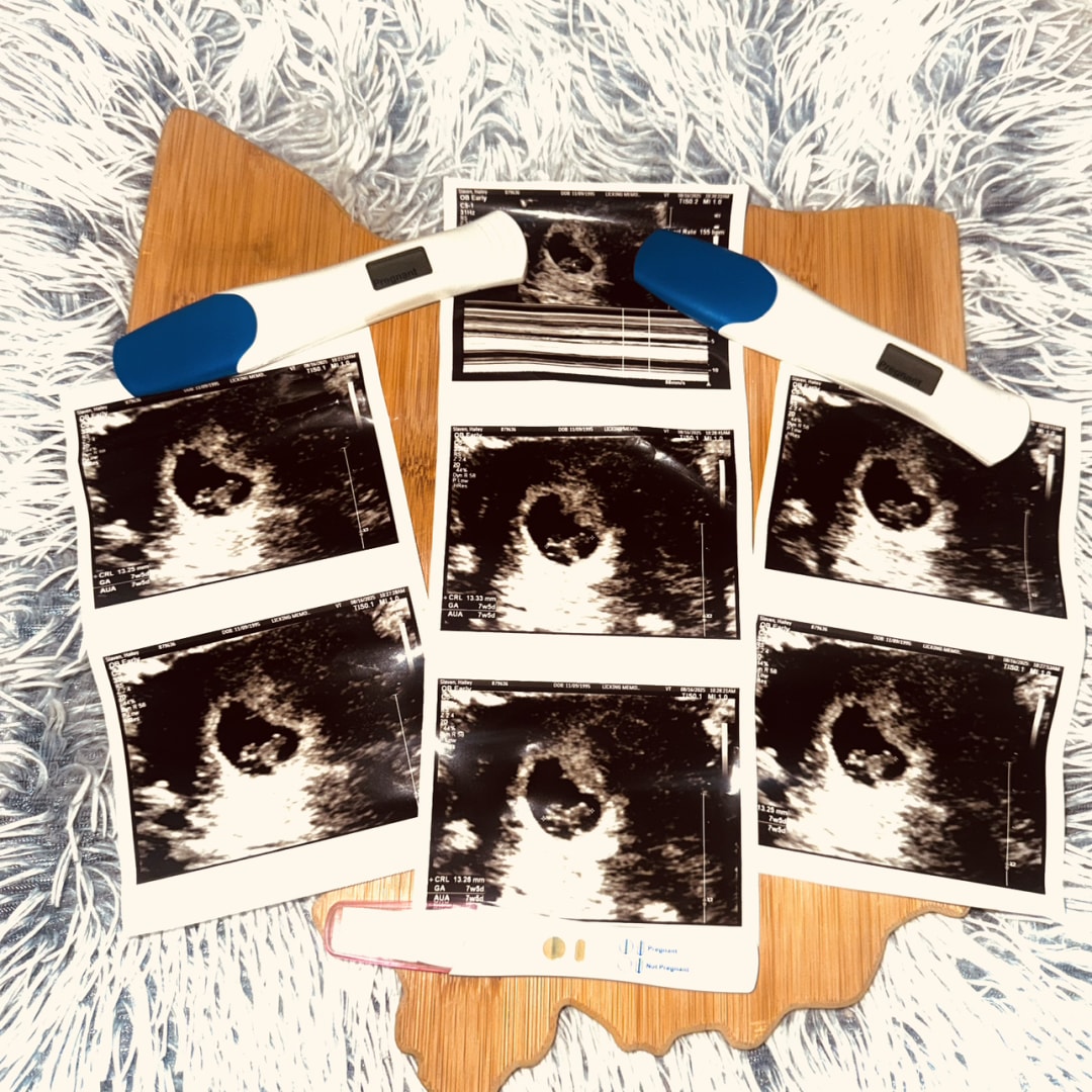 Photo shared by Hailey for their Babylist baby registry.