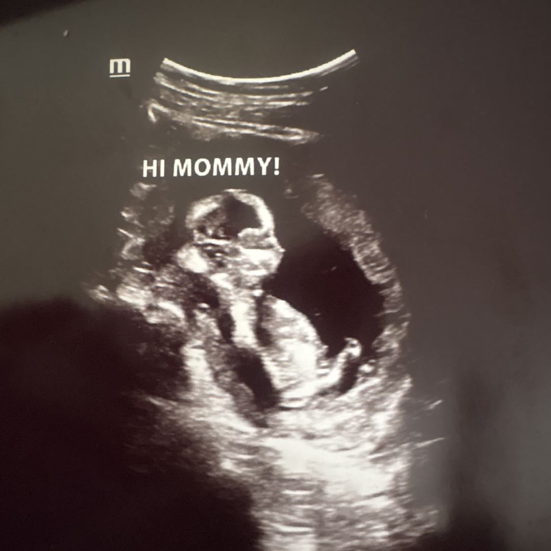 Photo shared by Julia for their Babylist baby registry.