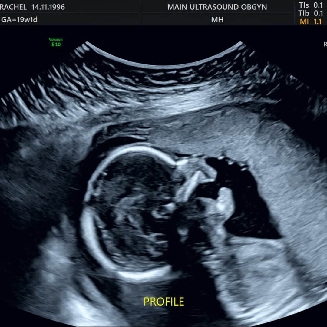 Photo shared by Rachel for their Babylist baby registry.