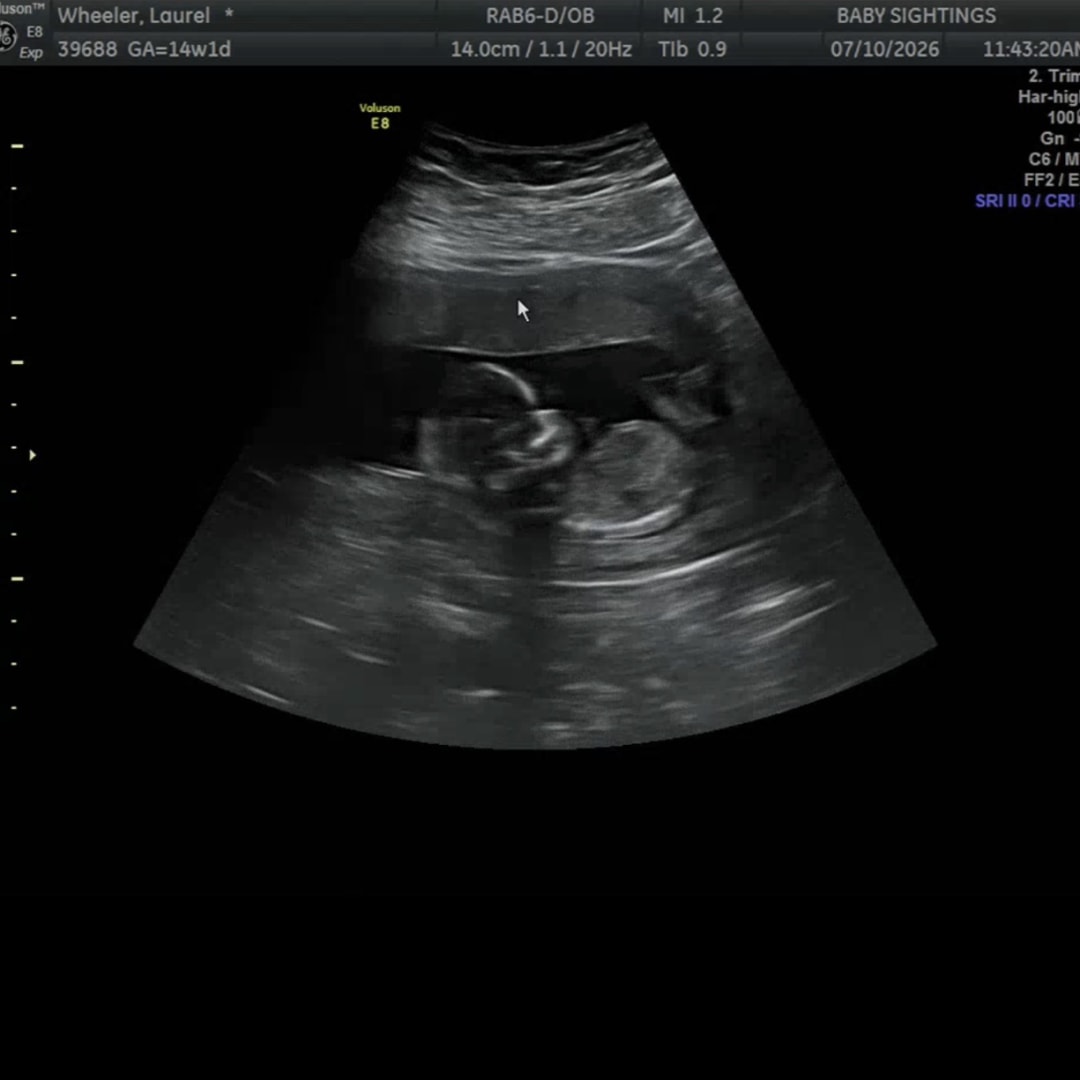 Photo shared by Laurel for their Babylist baby registry.