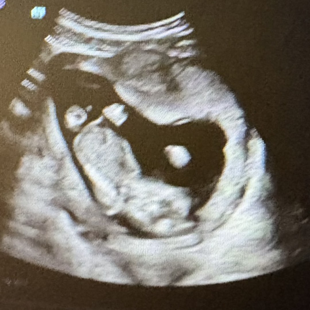 Photo shared by Mara for their Babylist baby registry.