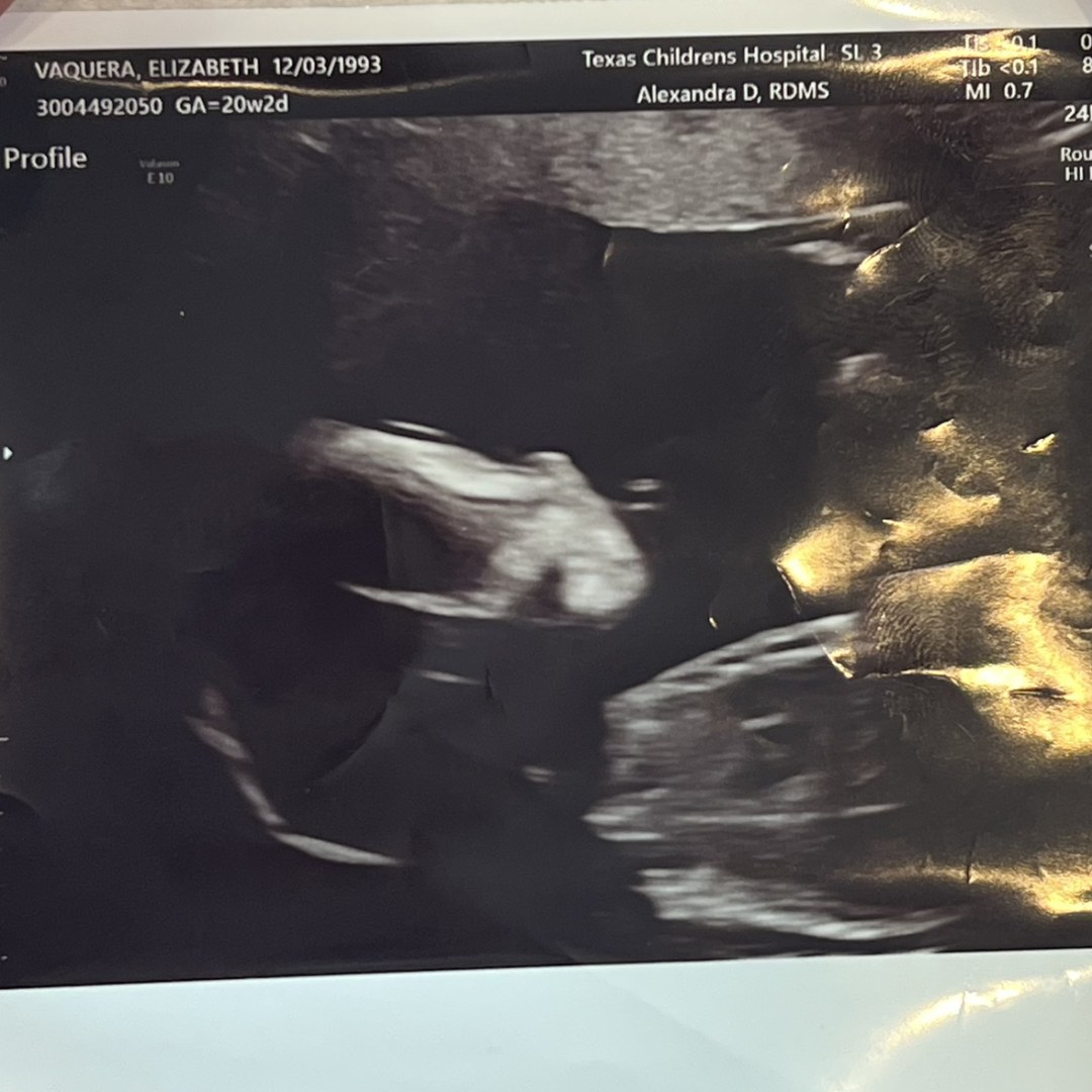 Photo shared by Elizabeth for their Babylist baby registry.