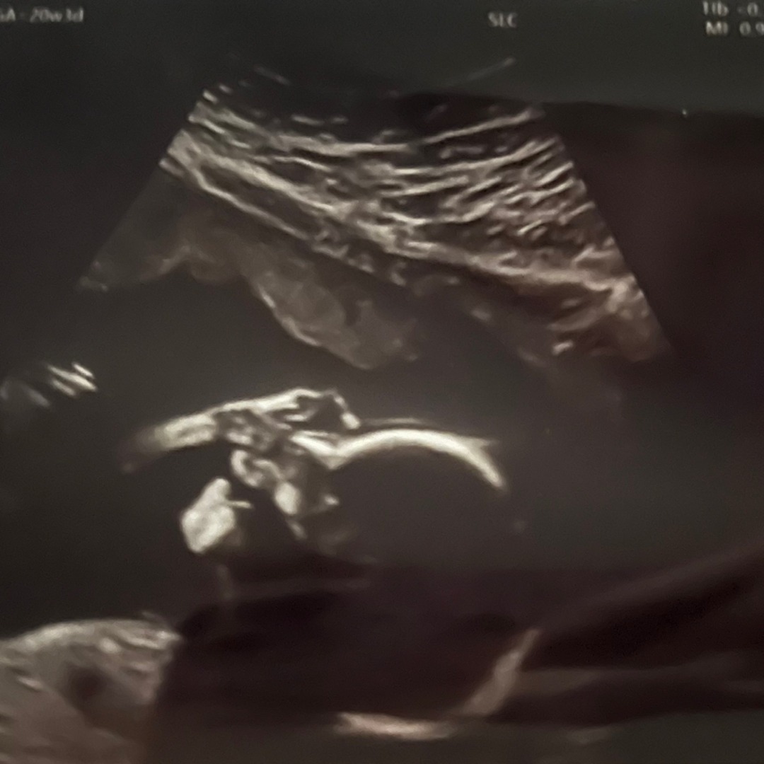 Photo shared by Siren for their Babylist baby registry.