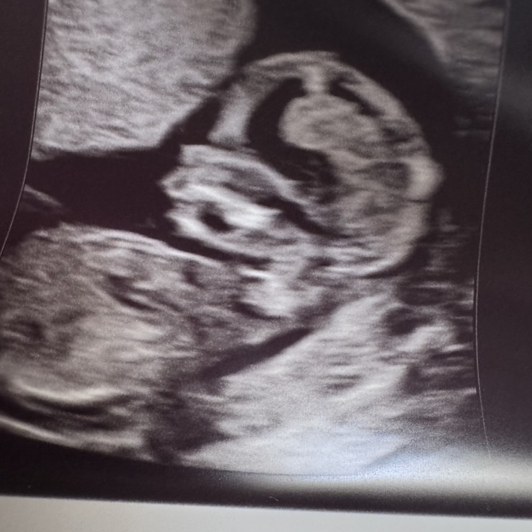 Photo shared by Brittany for their Babylist baby registry.