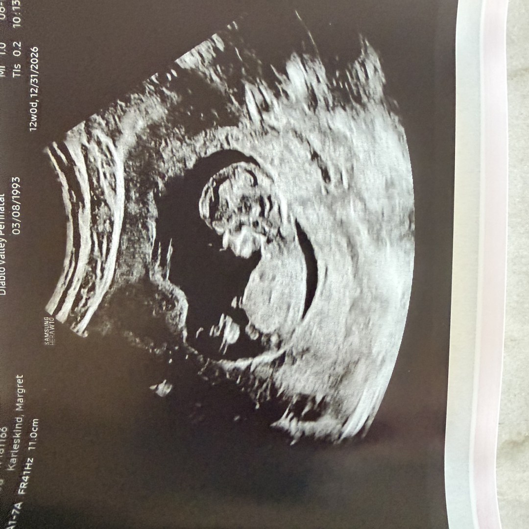 Photo shared by Maggie for their Babylist baby registry.