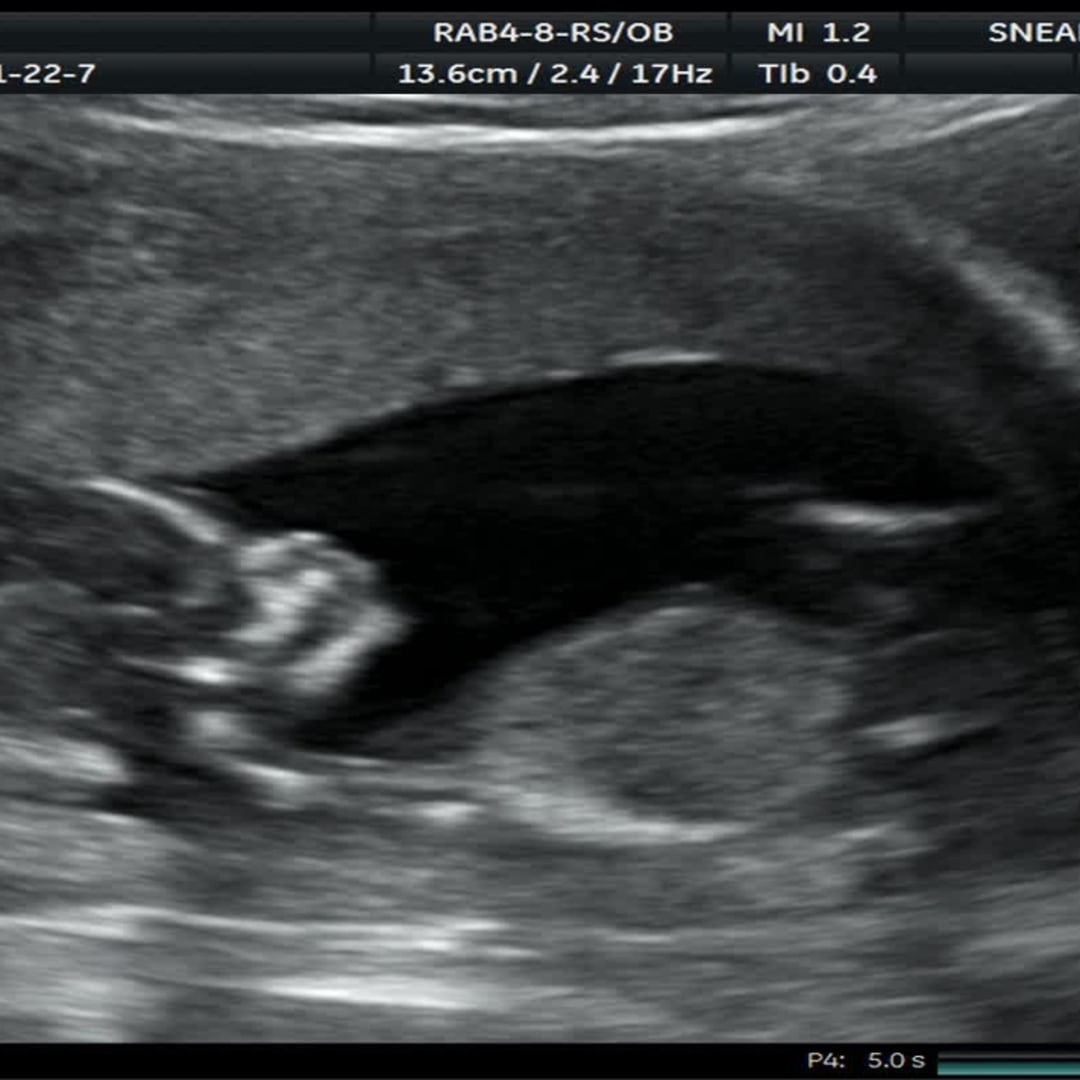 Photo shared by Brianna for their Babylist baby registry.