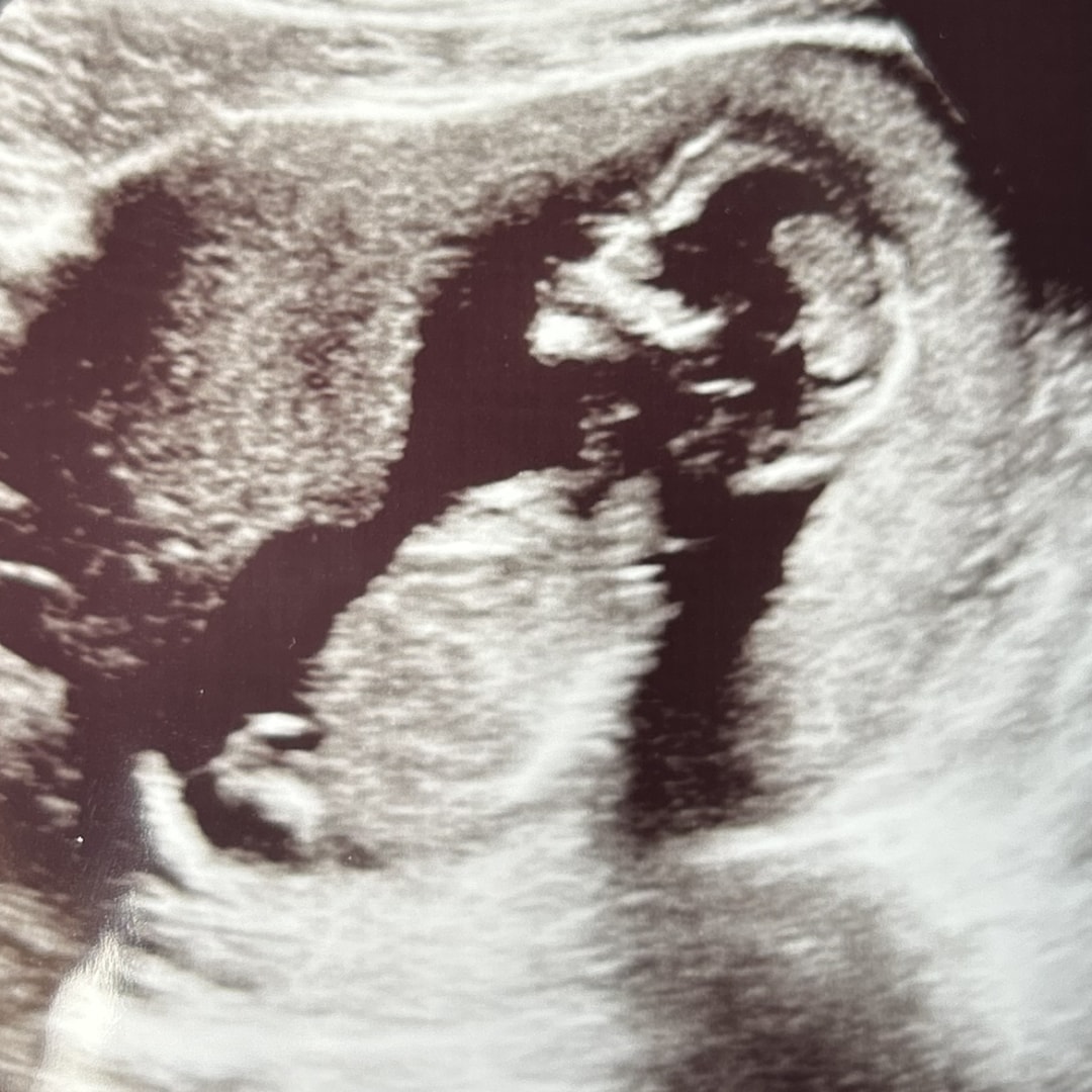 Photo shared by Alexus for their Babylist baby registry.