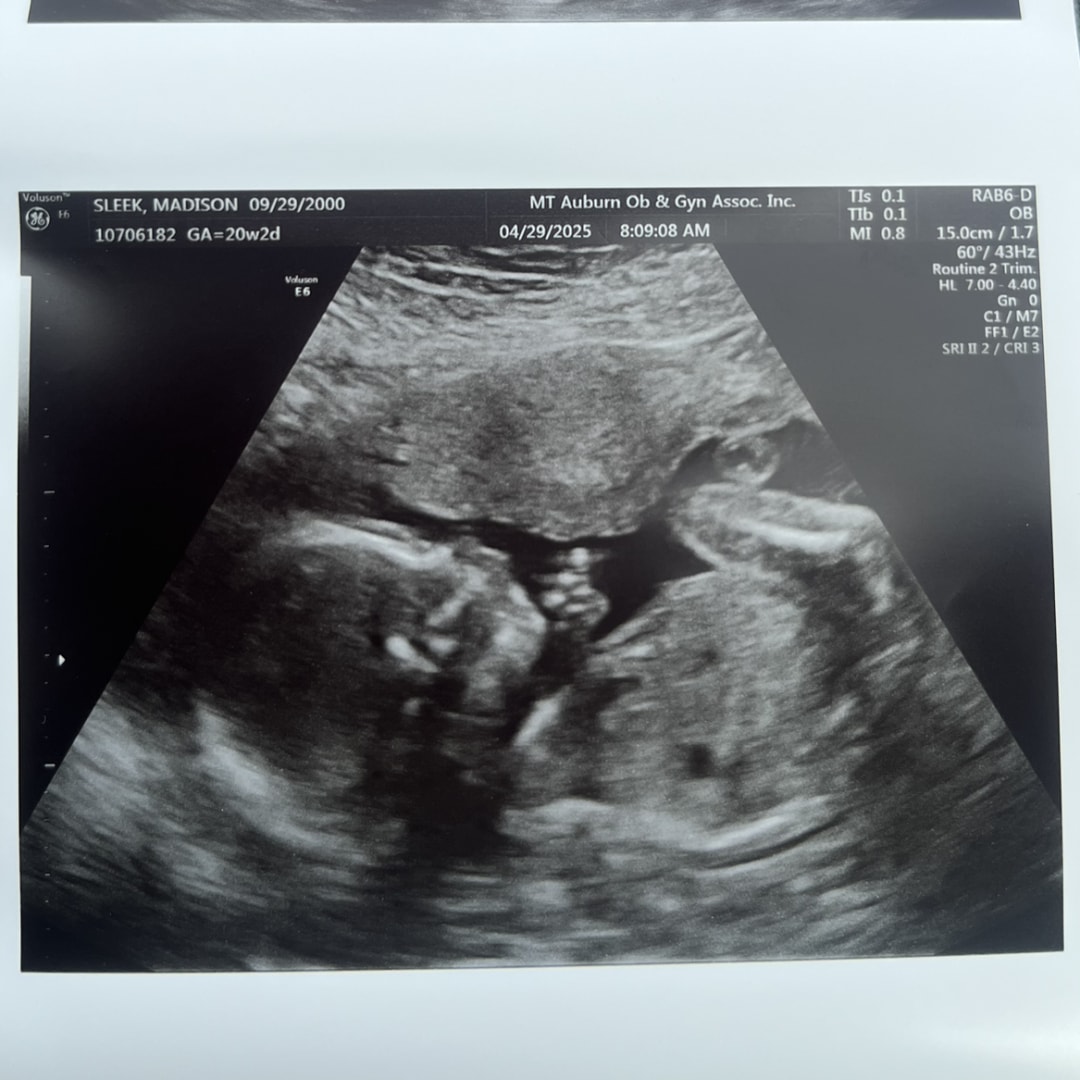 Photo shared by Madison for their Babylist baby registry.