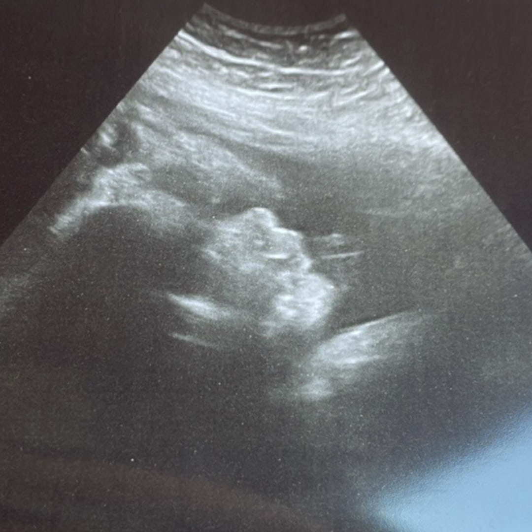 Photo shared by Ashley for their Babylist baby registry.