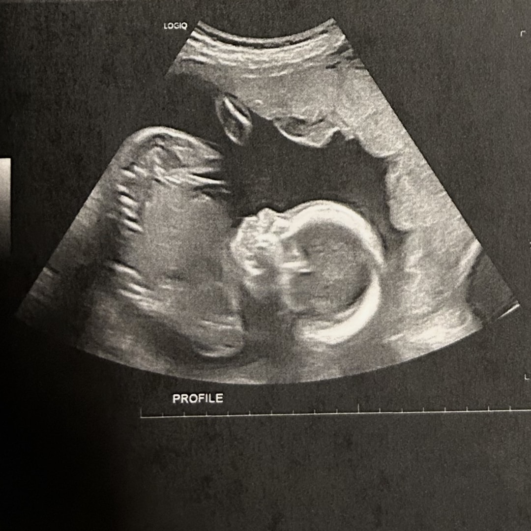 Photo shared by Brylea for their Babylist baby registry.