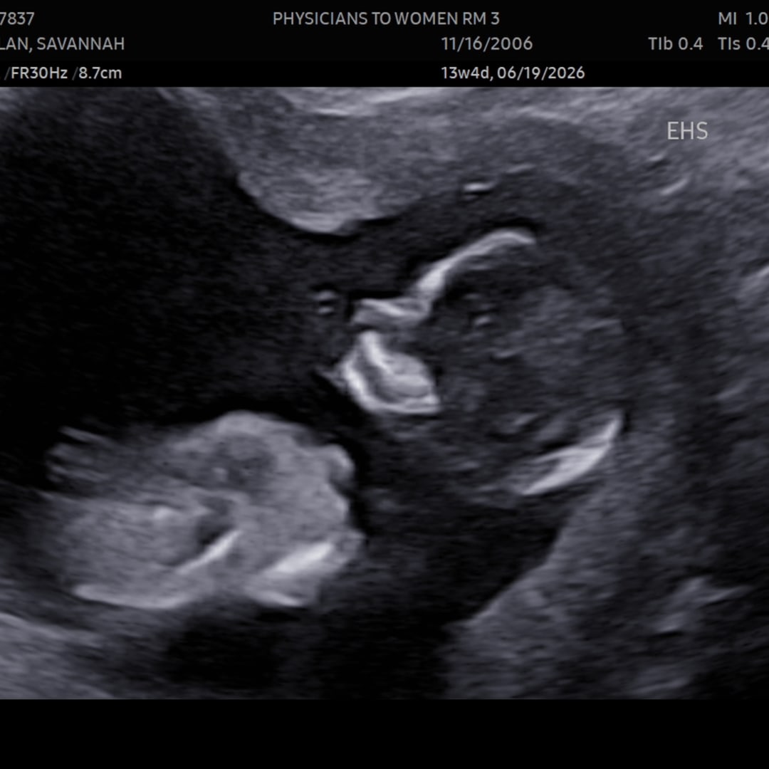 Photo shared by Savannah for their Babylist baby registry.