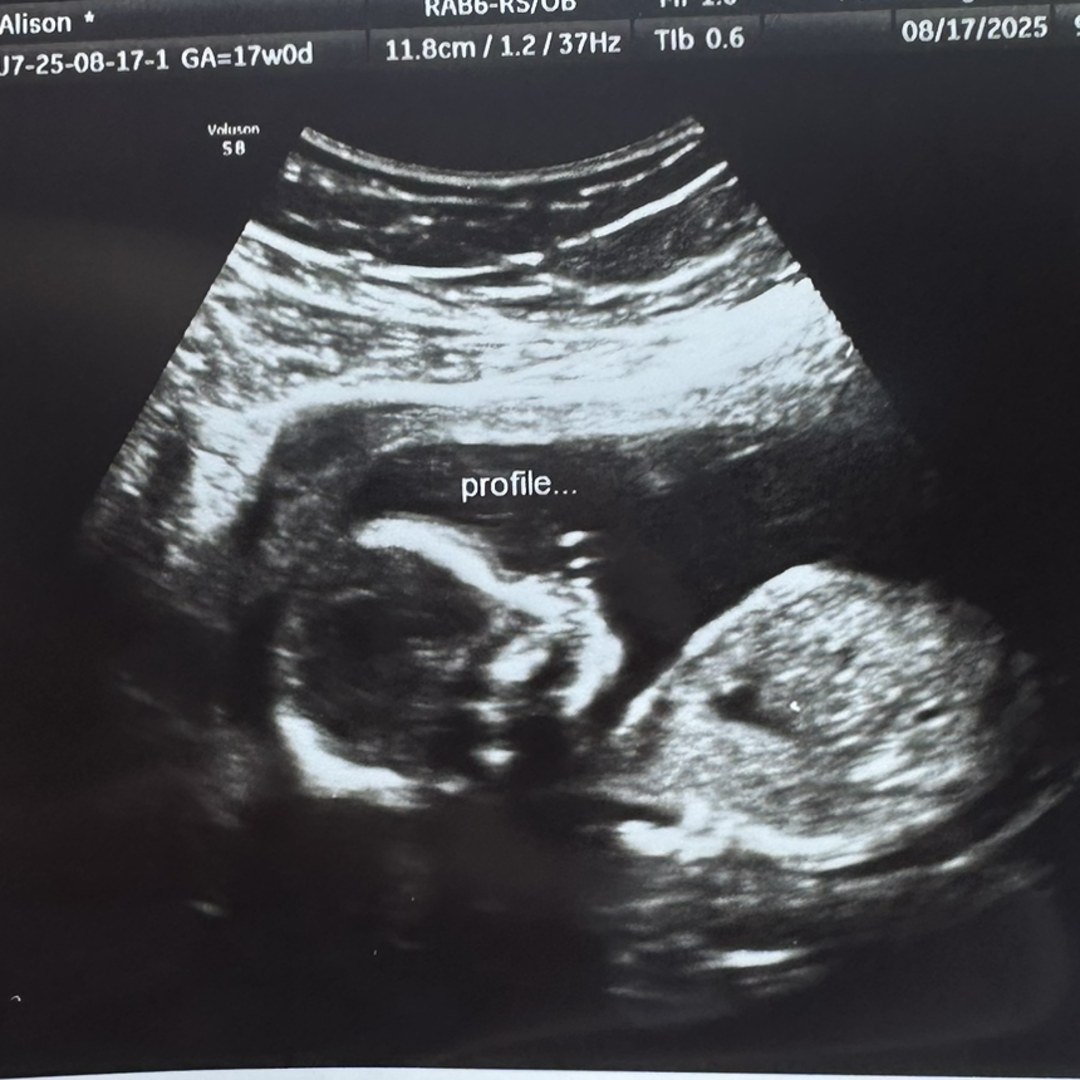 Photo shared by Alison for their Babylist baby registry.