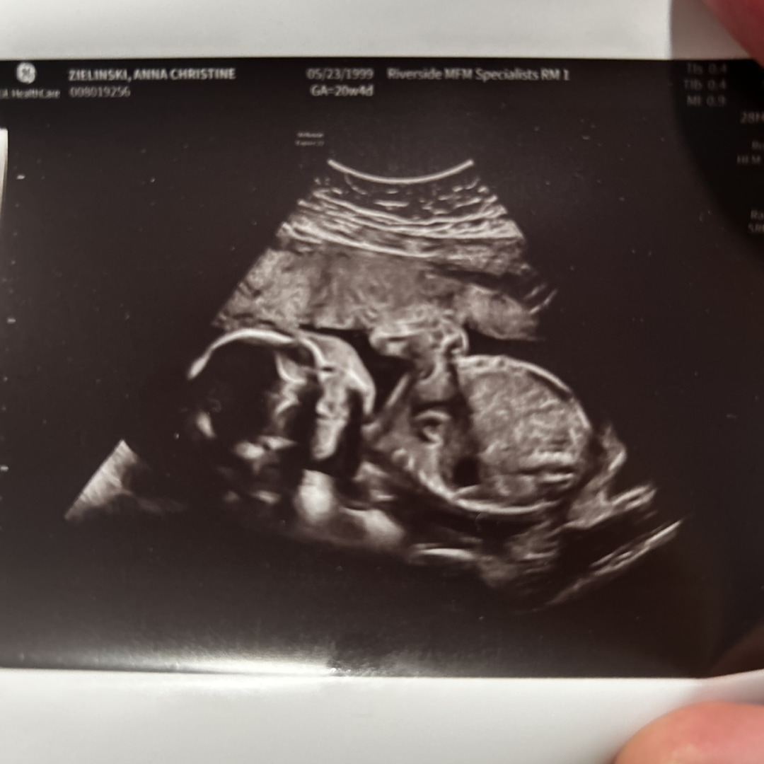 Photo shared by Anna for their Babylist baby registry.