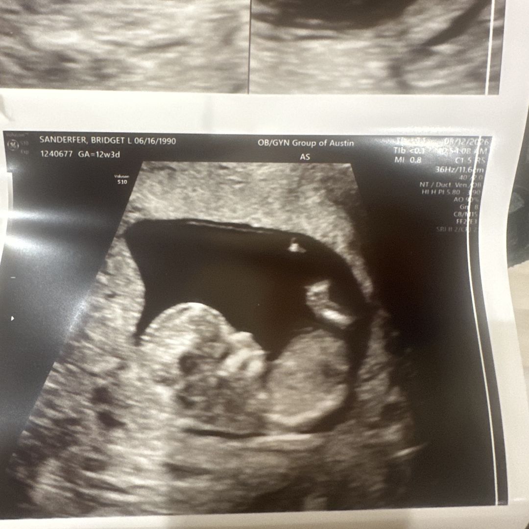 Photo shared by Bridget for their Babylist baby registry.