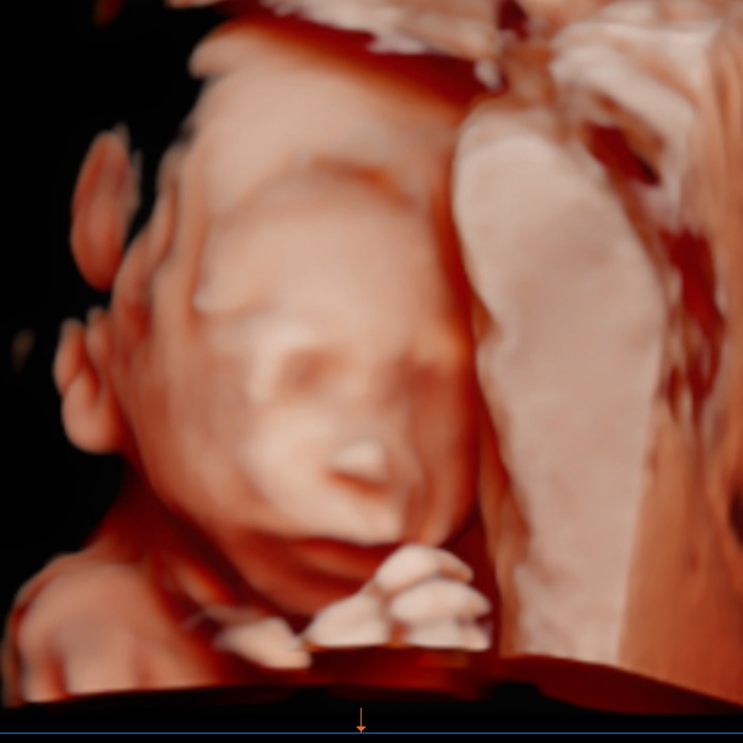 Photo shared by Will & TiNa for their Babylist baby registry.