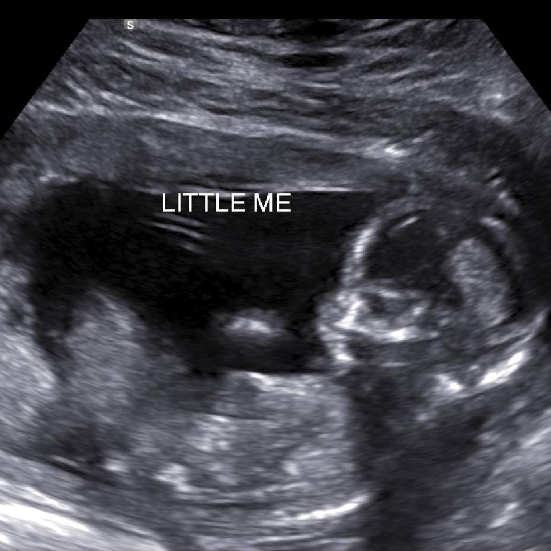 Photo shared by Isabella for their Babylist baby registry.