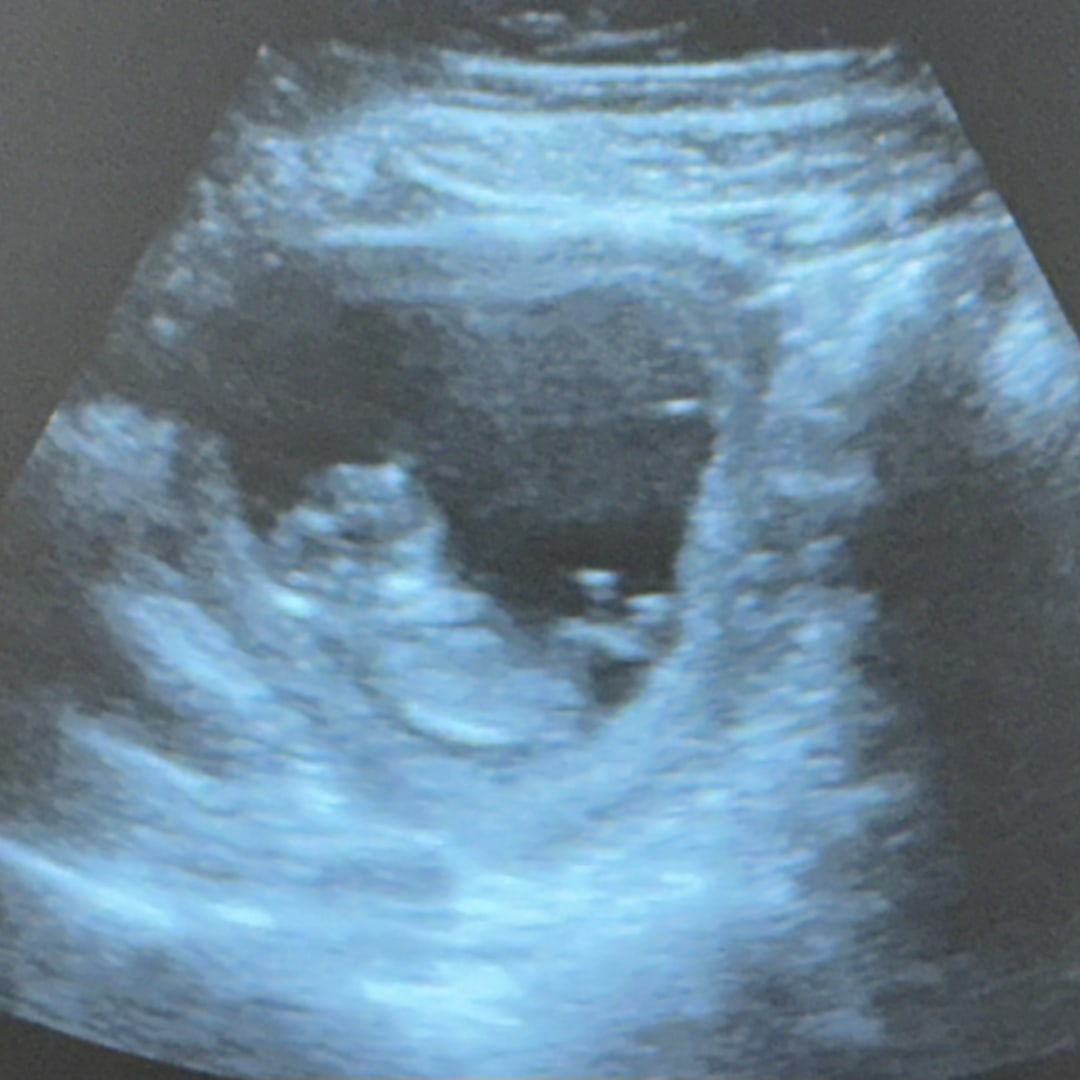 Photo shared by Dailyn for their Babylist baby registry.