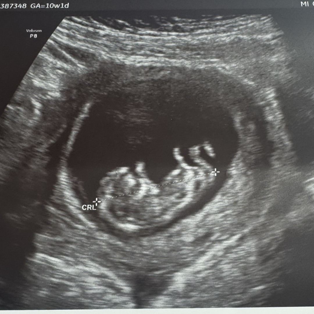 Photo shared by Mackewin for their Babylist baby registry.