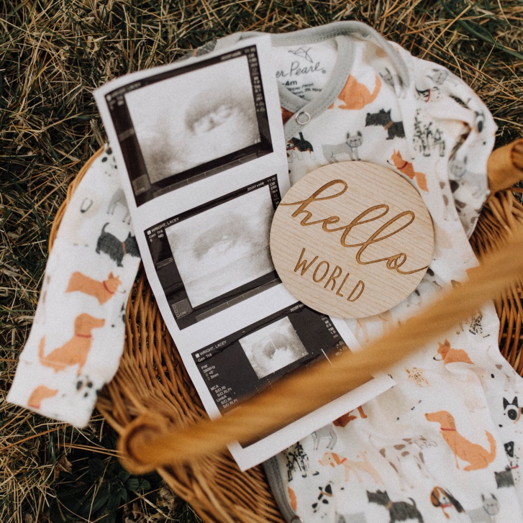 Photo shared by Lacey for their Babylist baby registry.