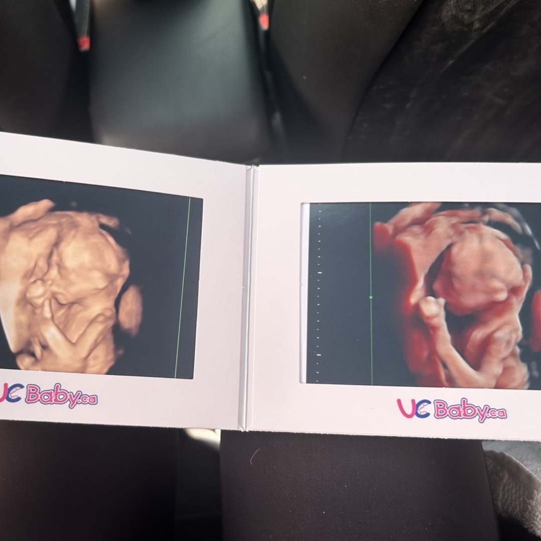 Photo shared by Shila for their Babylist baby registry.