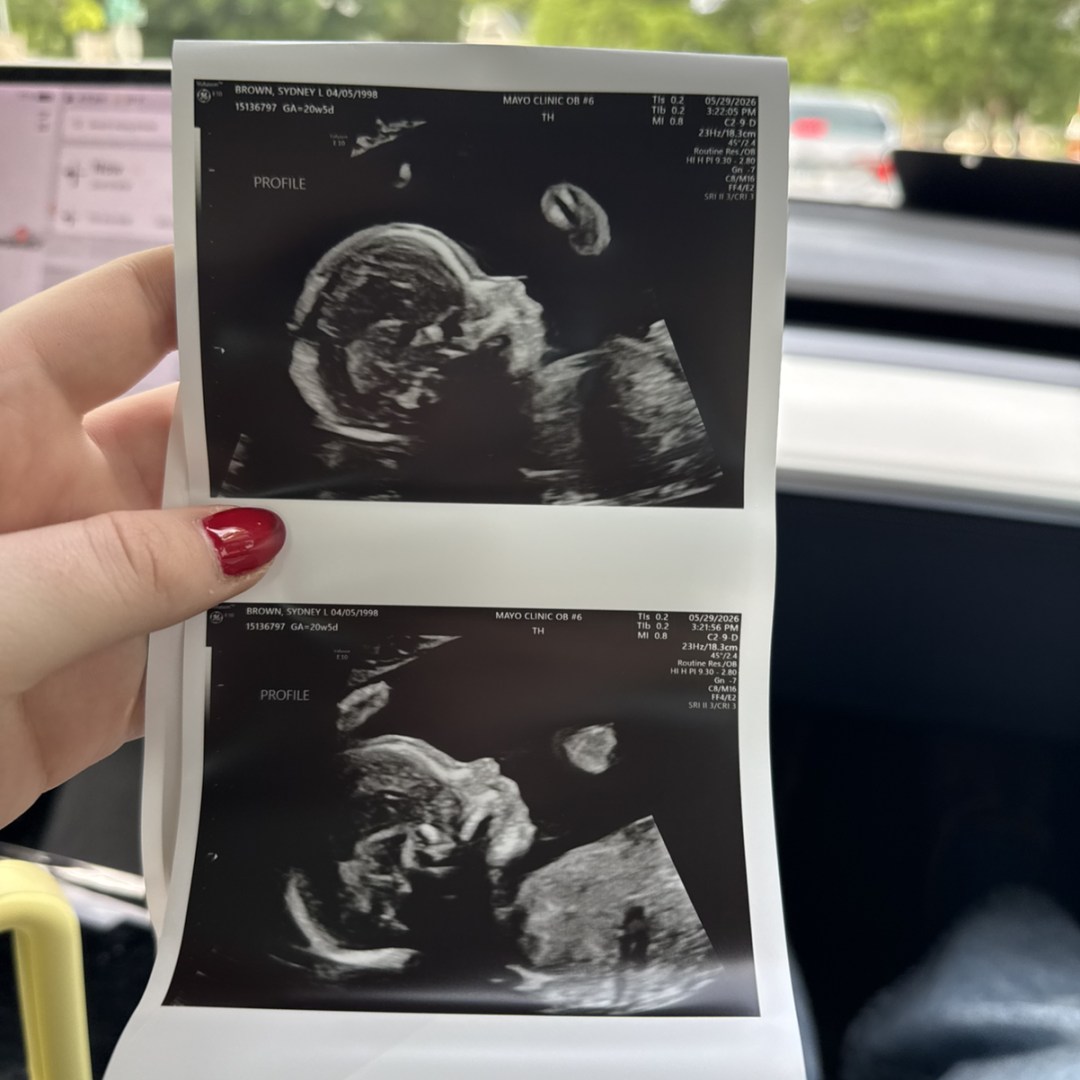 Photo shared by Sydney for their Babylist baby registry.