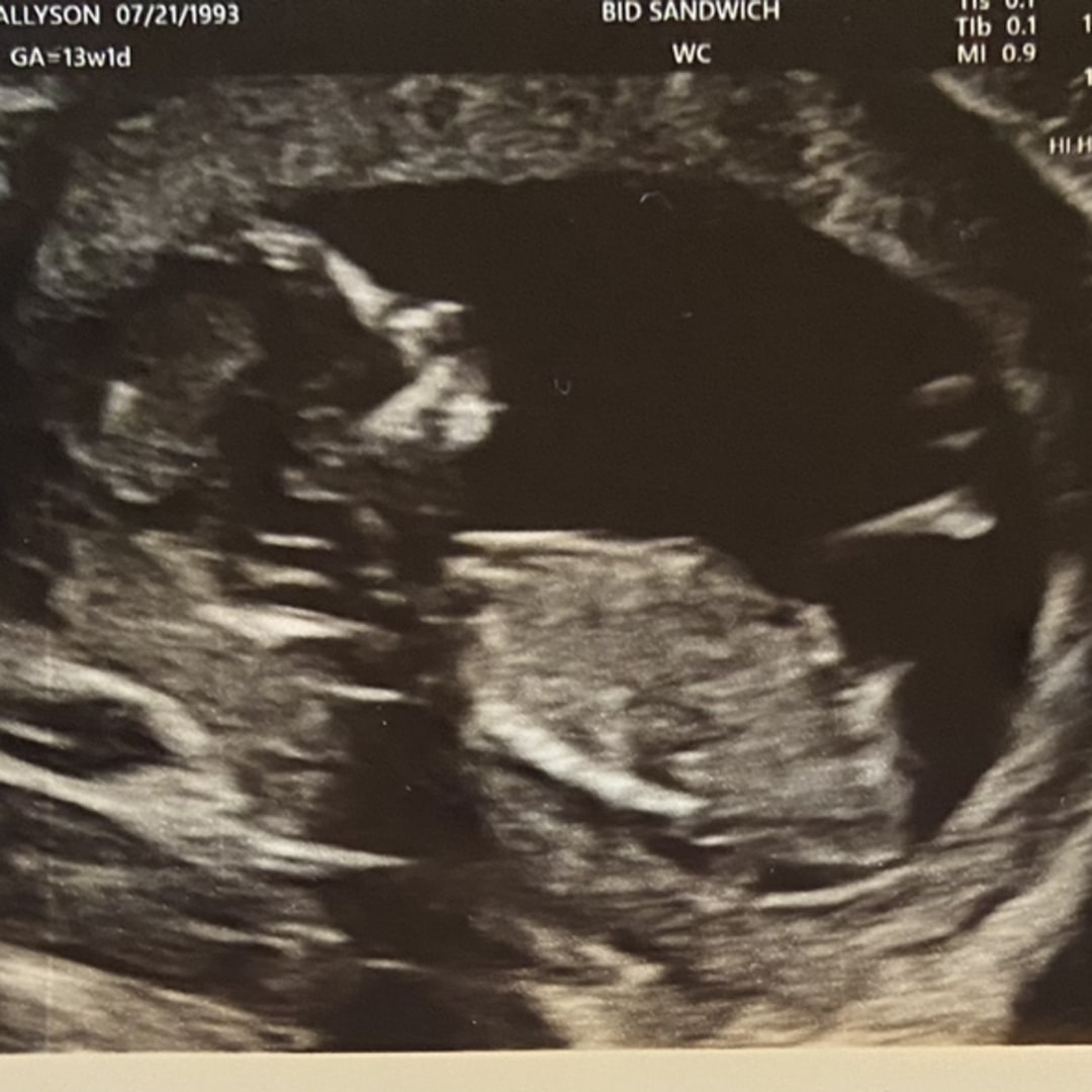 Photo shared by Allyson for their Babylist baby registry.