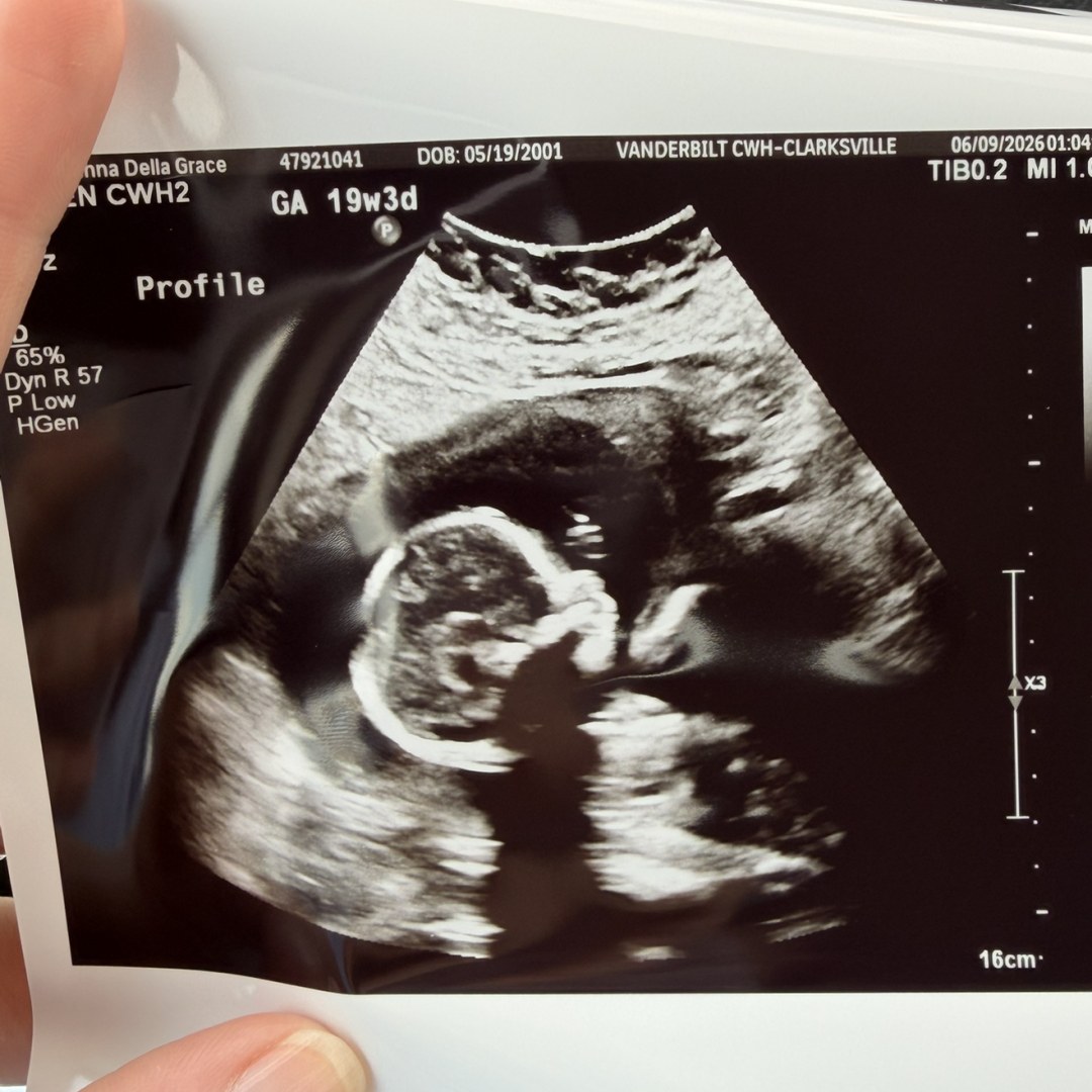 Photo shared by Grace for their Babylist baby registry.