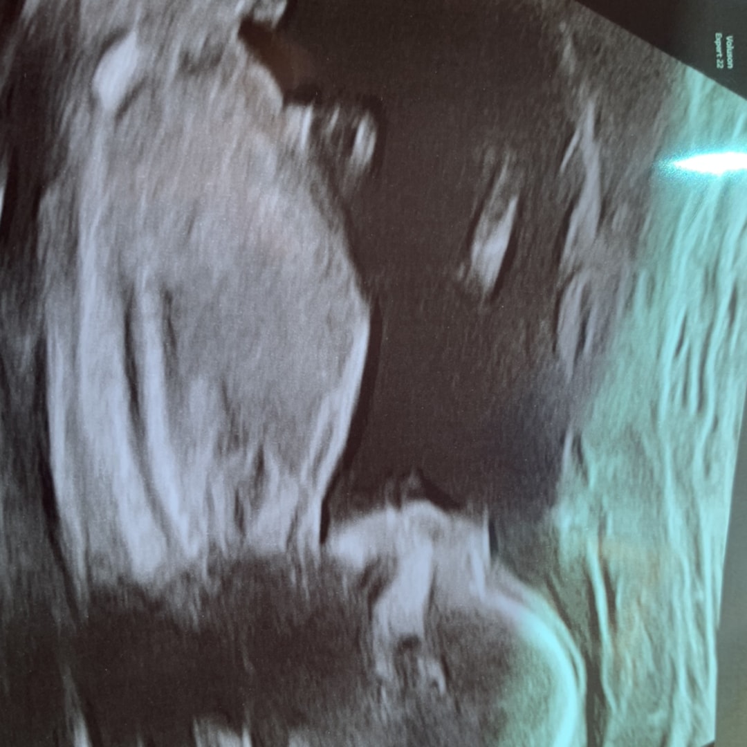 Photo shared by Maryann for their Babylist baby registry.