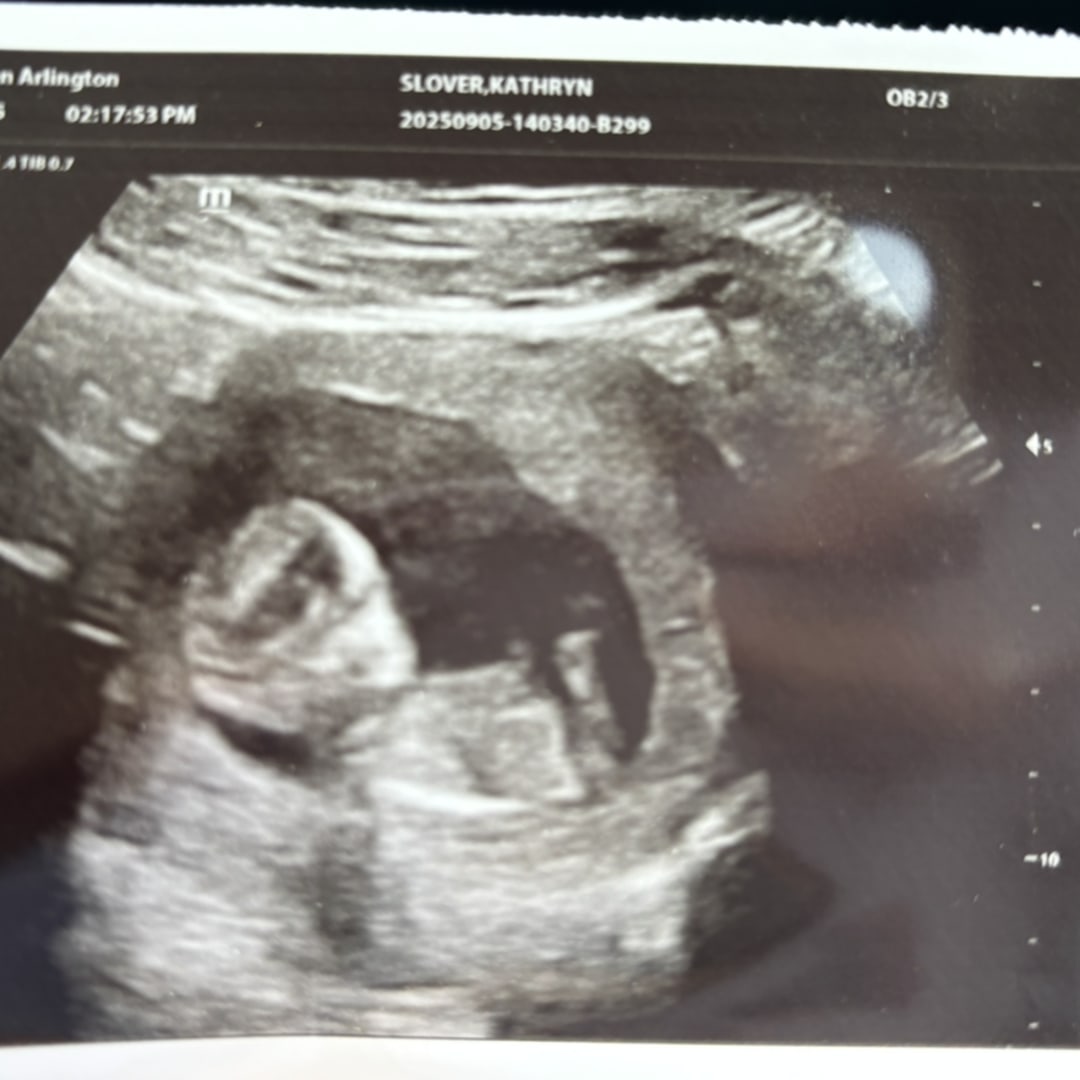 Photo shared by Kathryn for their Babylist baby registry.