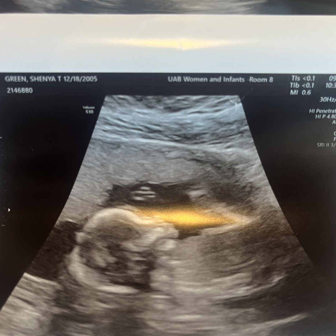 Photo shared by Shenya for their Babylist baby registry.