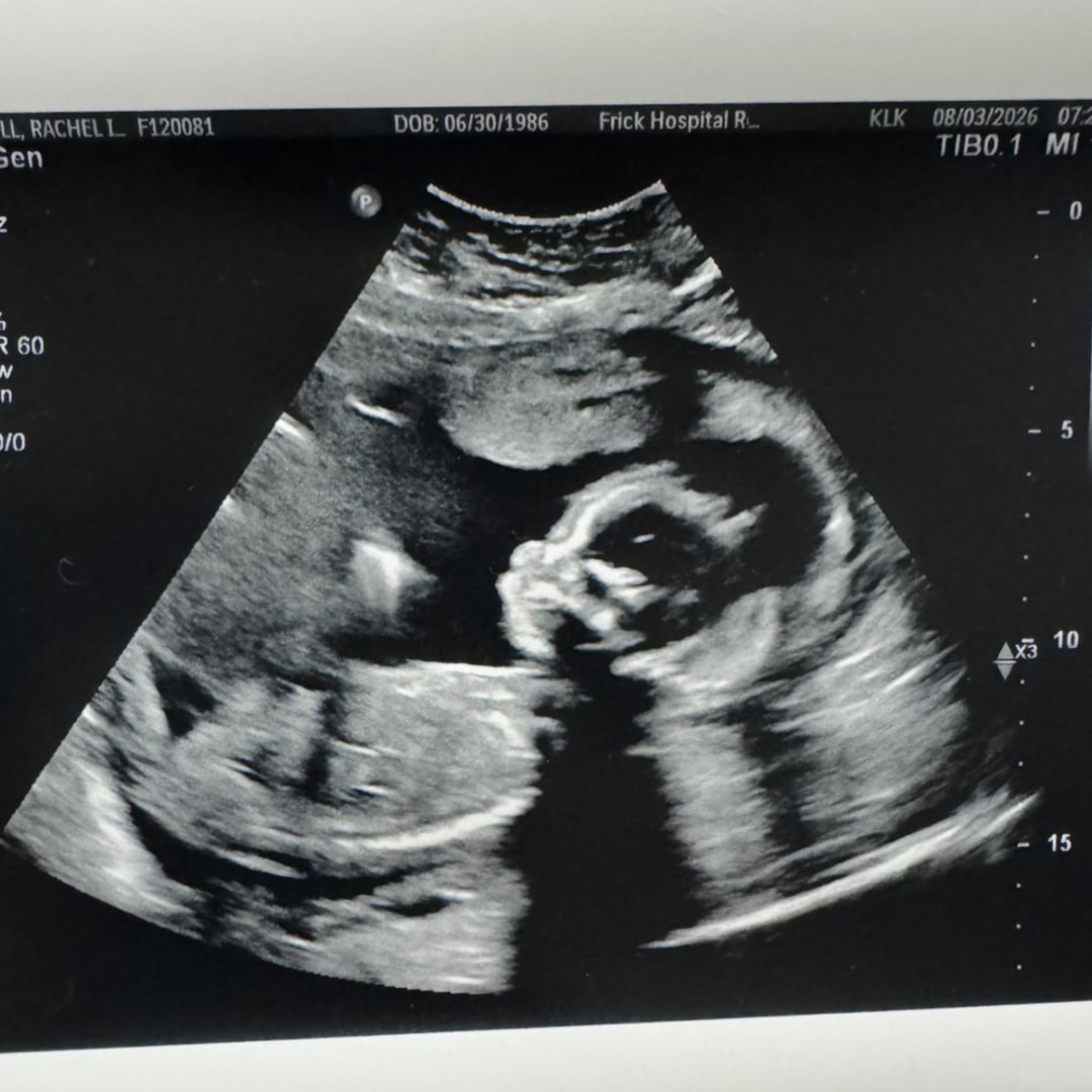 Photo shared by Rachel for their Babylist baby registry.