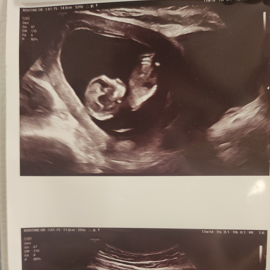 Photo shared by Savannah for their Babylist baby registry.