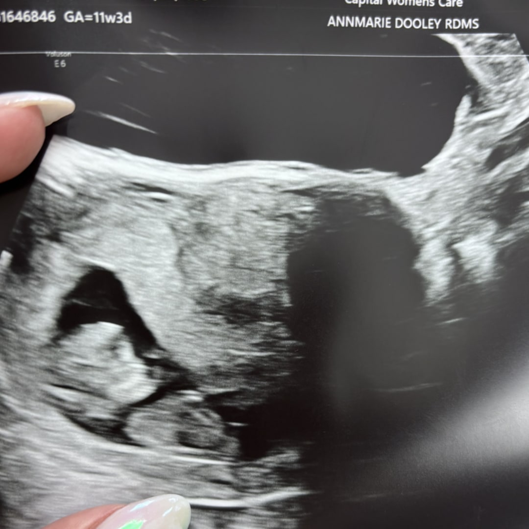 Photo shared by Kristin for their Babylist baby registry.