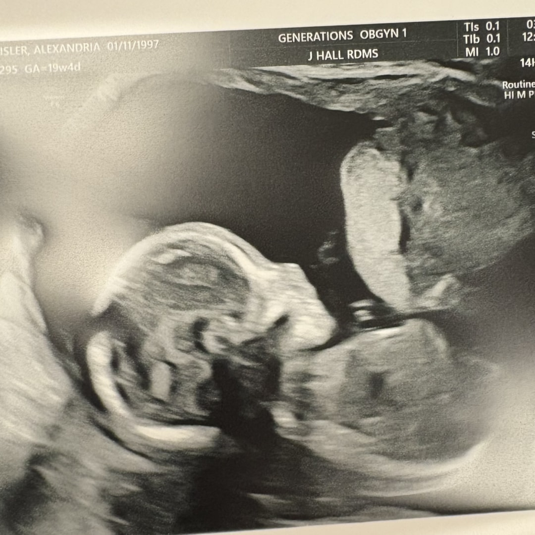 Photo shared by Alex for their Babylist baby registry.