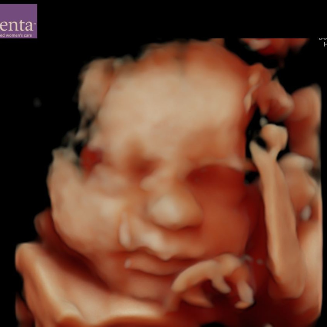 Photo shared by Lily for their Babylist baby registry.