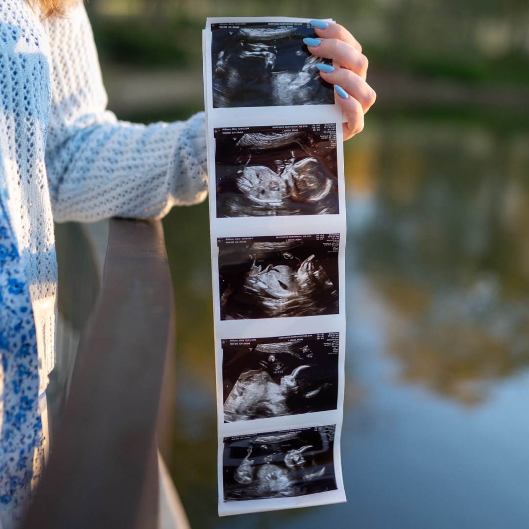 Photo shared by Alicia for their Babylist baby registry.