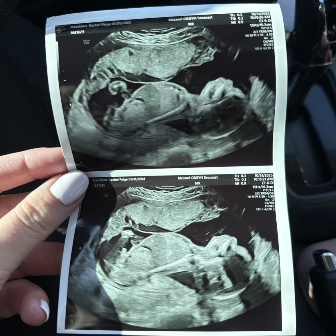 Photo shared by Rachel for their Babylist baby registry.