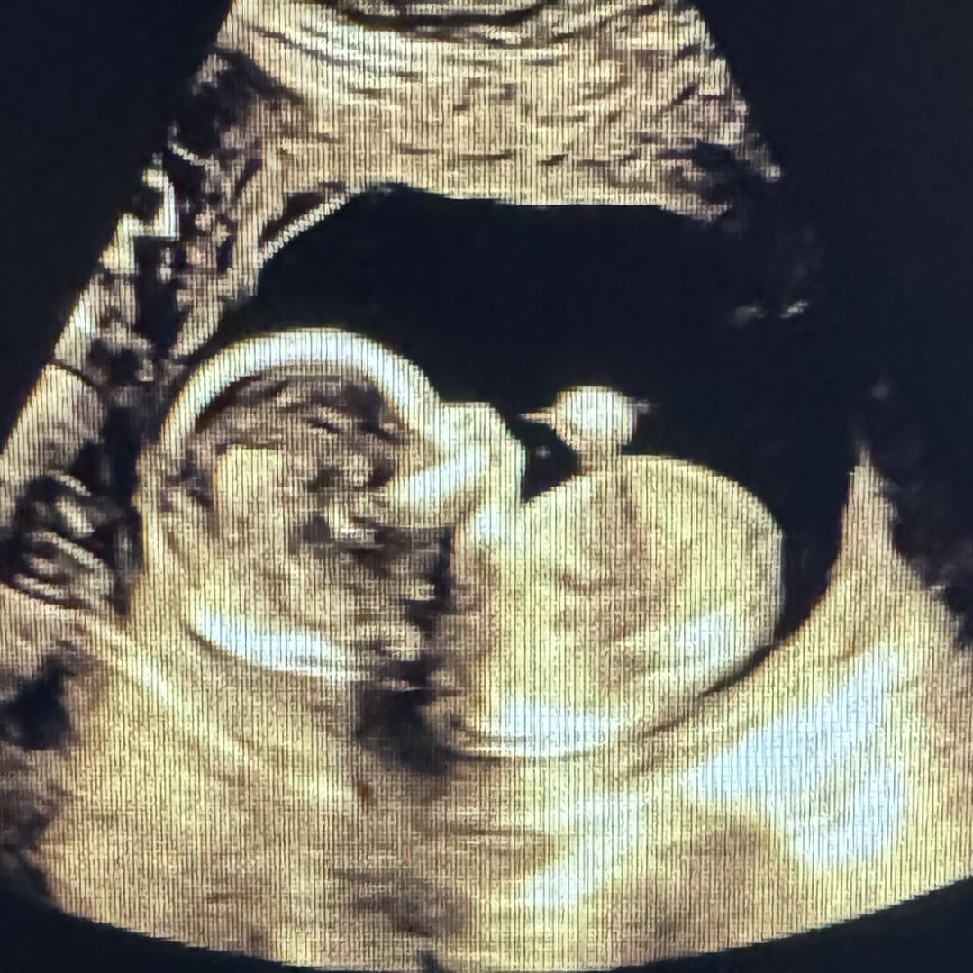 Photo shared by Baby K for their Babylist baby registry.